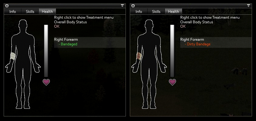 Project Zomboid Types of Injuries and Treatments - First Aid Guide - Bandaging - 7CE4938
